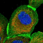 Immunofluorescent staining of human cell line A-431 shows localization to plasma membrane & cytosol.