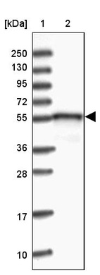 Lane 1: Marker [kDa] 250, 130, 95, 72, 55, 36, 28, 17, 10_br/_Lane 2: Human cell line RT-4