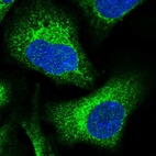 Immunofluorescent staining of human cell line U-2 OS shows localization to endoplasmic reticulum.