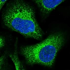 Immunofluorescent staining of human cell line U-2 OS shows localization to endoplasmic reticulum.