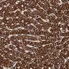 Immunohistochemical staining of human liver shows strong granular cytoplasmic positivity in hepatocytes.