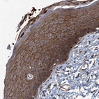 Immunohistochemical staining of human skin shows moderate membranous positivity in squamous epithelial cells.