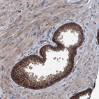 Immunohistochemical staining of human prostate shows strong membranous positivity in glandular cells.