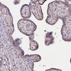Immunohistochemical staining of human placenta shows moderate cytoplasmic positivity in trophoblastic cells.