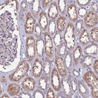 Immunohistochemical staining of human kidney shows moderate cytoplasmic positivity in cells in tubules.