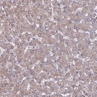 Immunohistochemical staining of human liver shows weak cytoplasmic positivity in hepatocytes.