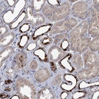 Anti-C11orf86 Antibody