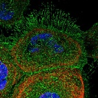 Immunofluorescent staining of human cell line A-431 shows localization to plasma membrane & cytosol.