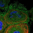 Immunofluorescent staining of human cell line A-431 shows localization to plasma membrane & cytosol.