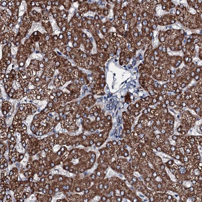 Anti-ACSS3 Antibody