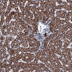 Anti-ACSS3 Antibody