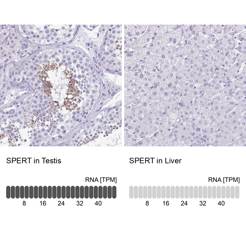 Anti-SPERT Antibody