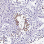 Immunohistochemical staining of human testis shows strong cytoplasmic positivity in spermatids.
