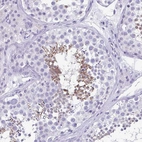 Immunohistochemical staining of human testis shows strong cytoplasmic positivity in spermatids.