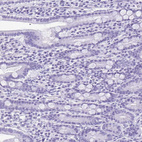 Immunohistochemical staining of human small intestine shows no positivity in glandular cells as expected.