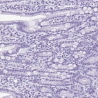 Immunohistochemical staining of human small intestine shows no positivity in glandular cells as expected.