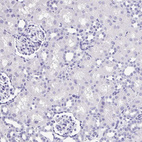 Immunohistochemical staining of human kidney shows no positivity in cells in tubules as expected.