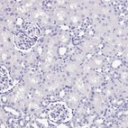 Immunohistochemical staining of human kidney shows no positivity in cells in tubules as expected.