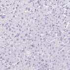 Immunohistochemical staining of human liver shows no positivity in hepatocytes as expected.
