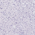 Immunohistochemical staining of human liver shows no positivity in hepatocytes as expected.