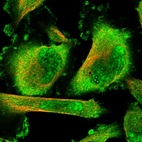 Immunofluorescent staining of human cell line U-251 MG shows localization to nucleus & plasma membrane.