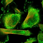 Immunofluorescent staining of human cell line U-251 MG shows localization to nucleus & plasma membrane.