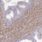 Immunohistochemical staining of human prostate shows moderate cytoplasmic positivity in smooth muscle cells.