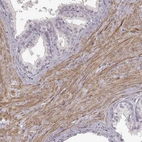 Immunohistochemical staining of human prostate shows moderate cytoplasmic positivity in smooth muscle cells.