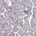Immunohistochemical staining of human placenta shows no cytoplasmic positivity in trophoblastic cells as expected.