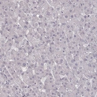 Immunohistochemical staining of human liver shows no cytoplasmic positivity in hepatocytes as expected.