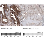 Anti-ERP29 Antibody