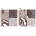 Immunohistochemical staining of human cerebral cortex, lymph node, prostate and skeletal muscle using Anti-ERP29 antibody HPA039363 (A) shows similar protein distribution across tissues to independent antibody HPA039456 (B).
