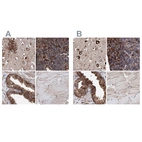 Immunohistochemical staining of human cerebral cortex, lymph node, prostate and skeletal muscle using Anti-ERP29 antibody HPA039363 (A) shows similar protein distribution across tissues to independent antibody HPA039456 (B).