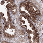 Immunohistochemical staining of human prostate shows high expression.