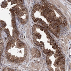 Immunohistochemical staining of human prostate shows high expression.
