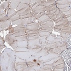 Immunohistochemical staining of human skeletal muscle shows low expression as expected.