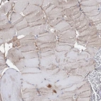 Immunohistochemical staining of human skeletal muscle shows low expression as expected.