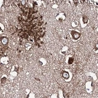 Immunohistochemical staining of human cerebral cortex using Anti-ERP29 antibody HPA039363.