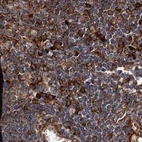 Immunohistochemical staining of human lymph node using Anti-ERP29 antibody HPA039363.