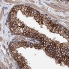 Immunohistochemical staining of human prostate using Anti-ERP29 antibody HPA039363.