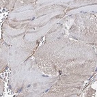 Immunohistochemical staining of human skeletal muscle using Anti-ERP29 antibody HPA039363.