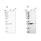Western blot analysis using Anti-ERP29 antibody HPA039363 (A) shows similar pattern to independent antibody HPA039456 (B).