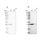 Western blot analysis using Anti-ERP29 antibody HPA039363 (A) shows similar pattern to independent antibody HPA039456 (B).