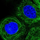 Immunofluorescent staining of human cell line A-431 shows localization to microtubules.