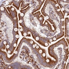 Anti-CHID1 Antibody