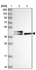Lane 1: Marker [kDa] 250, 130, 95, 72, 55, 36, 28, 17, 10_br/_Lane 2: Human cell line RT-4_br/_Lane 3: Human cell line U-251MG sp