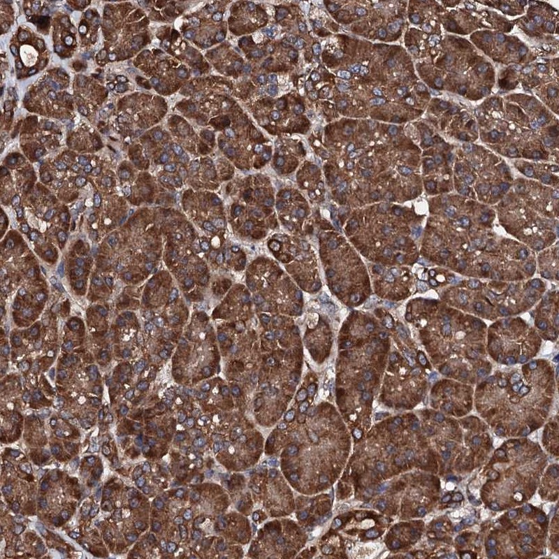 Anti-CKAP5 Antibody