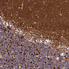 Immunohistochemical staining of human cerebellum shows strong cytoplasmic positivity.