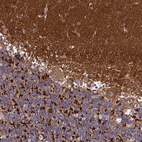 Immunohistochemical staining of human cerebellum shows strong cytoplasmic positivity.