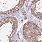 Immunohistochemical staining of human testis shows moderate cytoplasmic positivity.